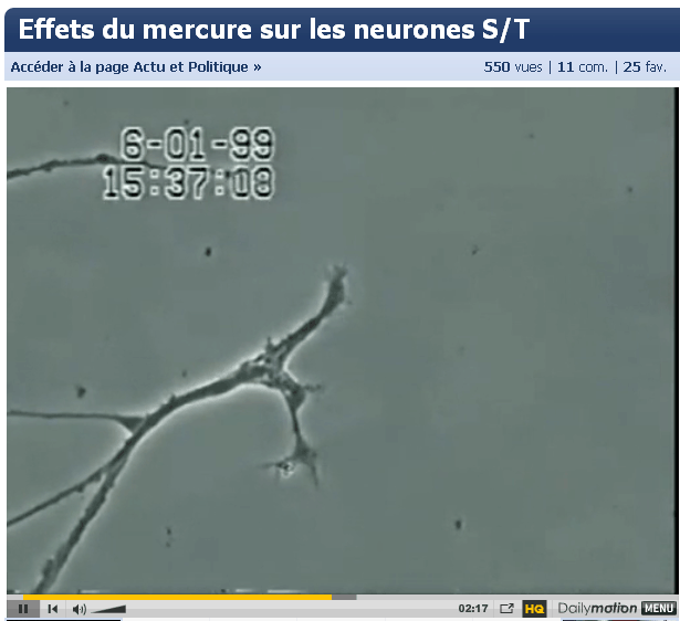 mercure attaque neurone